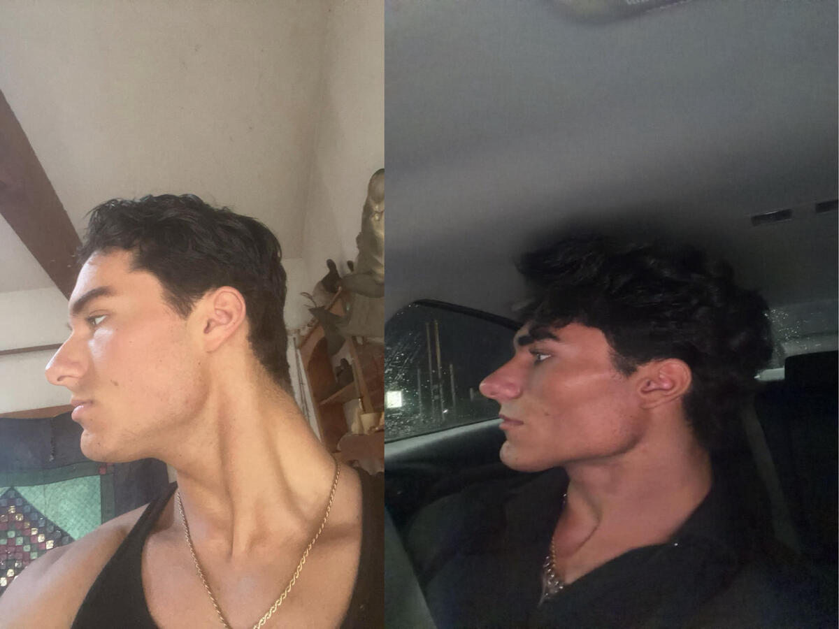 Me Before &amp; After- 7 Months