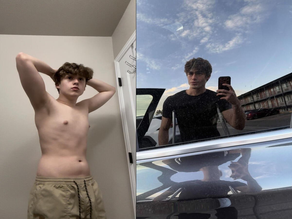 Eli Before & After- 4.5 Months